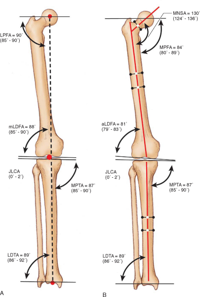 CHAPTER 59 – - TeachMe Orthopedics